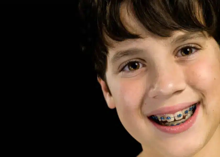 What is a two-phase orthodontics treatment